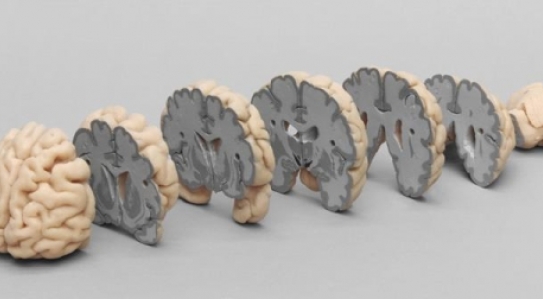 NEW // Human Brain Multiple Frontal Sections