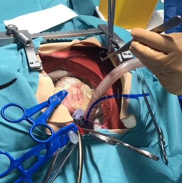 High-Fidelity Cardiothoracic Surgical Trainer (High-Fidelity CT Surgical Trainer)