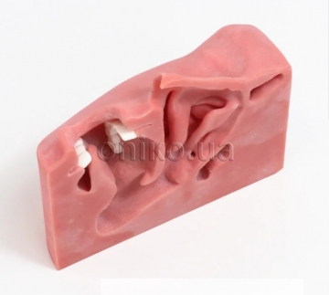 Replacement Sinus / Tonsil Tissue Insert