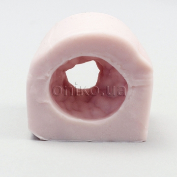 EMS Duodenal Stricture