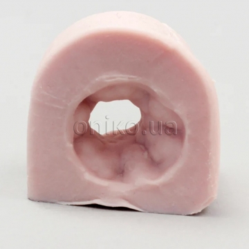 EMS Colonic Stricture