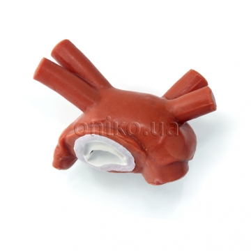 Normální mitrální chlopeň bez chord a papilárních svalů