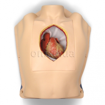 Hrudník s úplnou sternotomií