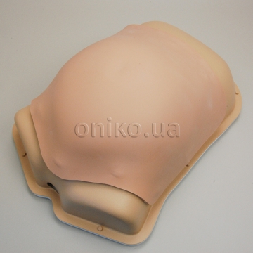 Kožní komponent pro laparoskopickou kýlu pro pokročilý AST