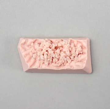 Bioptický disk žaludku – tkáň