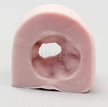 Střevní tkáň se strikturou