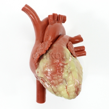 Srdce pro aortokoronární bypass