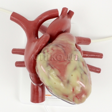 Kanylovatelné větší bijící srdce