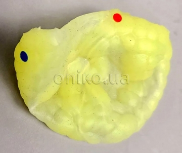 Epikardiální návlek