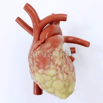 Srdce s vyměnitelným ouškem levé síně