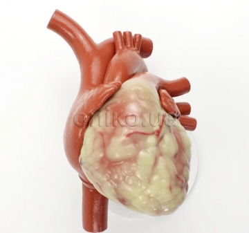 Nepatentovaný model srdce