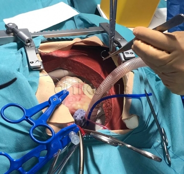 Kardiochirurgický trenažér s vysokou věrností