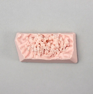 EMS Biopsy Disc for Stomach