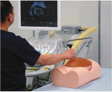 Ultrazvuková diagnostika (ultrazvuk)