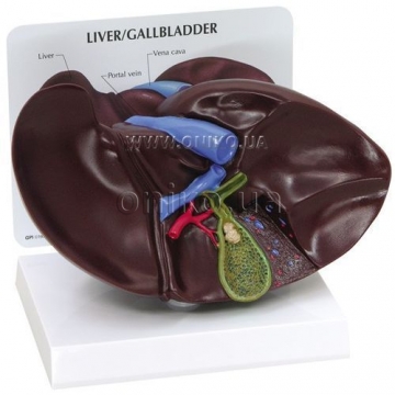 Liver/Gallbladder with gallstones
