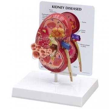 Kidney Normal/Pathology