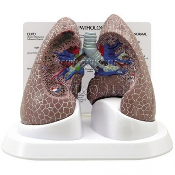 Lung Set with pathologies