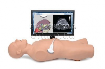 CAE Vimedix Abdo - trénink ultrazvuku břišních orgánů