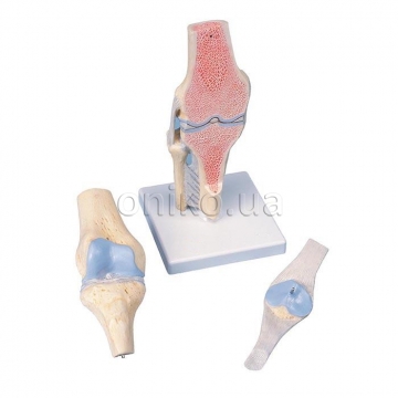 Модель колінного суглоба у розрізі, 3 частини