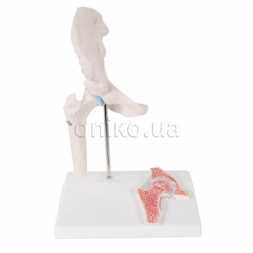 Мини-модель тазобедренного сустава человека с поперечным сечением