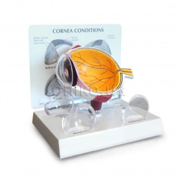 Cornea Eye