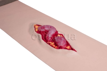 Dissected abdominal wound moulage